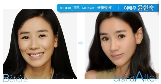 그랜드성형외과 홈페이지 © News1