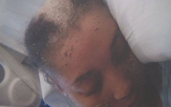 머리에서 손톱이 자라는 미국 여성 사니나 이솜(28) (허핑턴포스트)© News1  