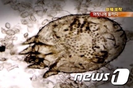 머릿니를 확대한 모습/KBS 방송 화면 캡처/뉴스1© News1 