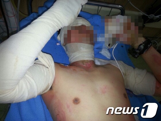 16일 오후 3시10분께 광주시 서구 광천동 기아자동차 2공장 앞 천막 인근에서 사내하청분회 조직부장 김모&#40;37&#41;씨가 분신을 시도했다. 김씨가 광주의 한 대학병원에서 치료를 받고 있다. 2013.4.16/뉴스1 © News1 
