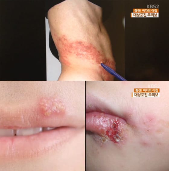 KBS2 뉴스 화면