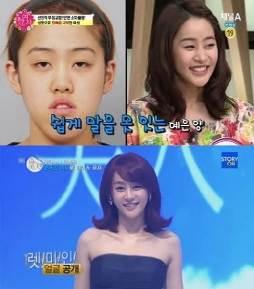 채널A '혼자 사는 여자'© News1  