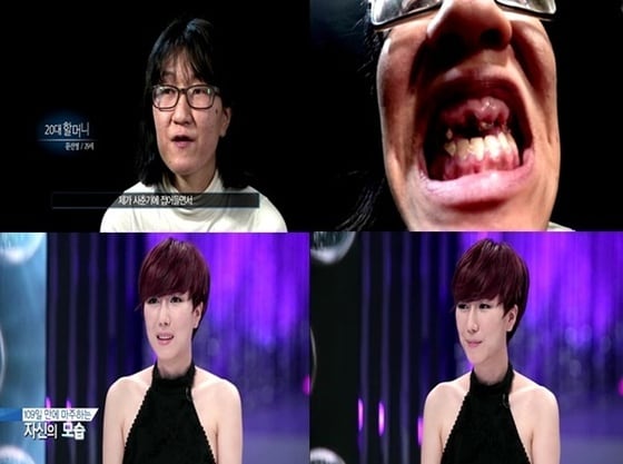 20대 할머니로 불린 렛미인 도전자가 새 삶을 찾았다. © 스토리온 '렛미인4' 캡처