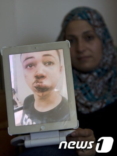 팔레스타인계 미국인 소년 타리크 아부 크데르(15)의 모친이 자기 아들이 이스라엘 경찰에게 구타당한 모습을 찍은 사진을 5일(현지시간) 공개하고 있다. © News1 