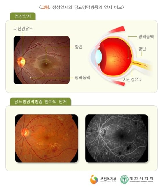 보건복지부 제공