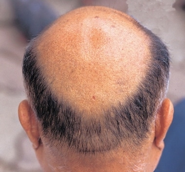 사진출처 : 리크리홀딩컴퍼니 ⓒ News1