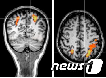 운전, 게임 등 복잡한 시각정보 처리과정은 뇌의 뒤쪽 정수리에 있는 후두정엽이라는 부위에서 처리된다는 사실이 밝혀졌다. 사진의 밝은 연두색 부분이 후두정엽 내의 두정엽내고랑으로 뒤와 위에서 각각 촬영한 것이다.(한국뇌연구원 제공)ⓒ News1
