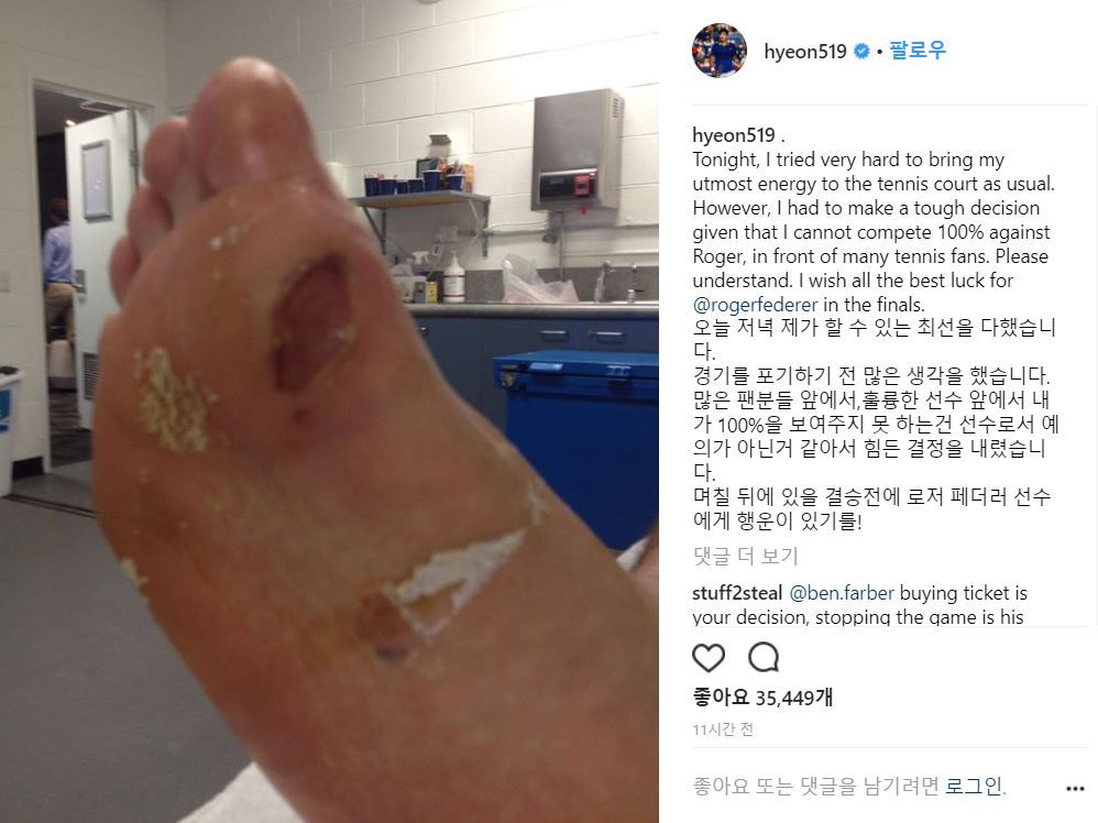 정현이 26일(한국시간) 로저 페더러와의 호주오픈 4강전을 마친 뒤 자신의 SNS에 오른발 발바닥에 물집이 잡힌 사진을 올렸다. (정현 인스타그램 갈무리)ⓒ News1