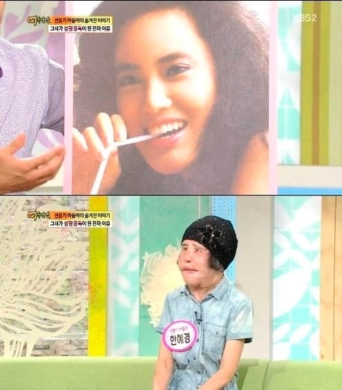 '선풍기 아줌마' 한혜경씨/사진=KBS 캡처 ⓒ News1