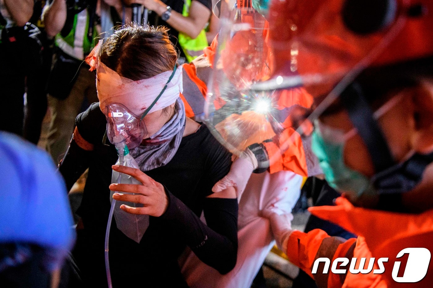 11일  송환법 완전 철폐 등을 요구하는 홍콩 시위대가 부상을 당해 치료를 받고 있다. ⓒ AFP=뉴스1 ⓒ News1 우동명 기자