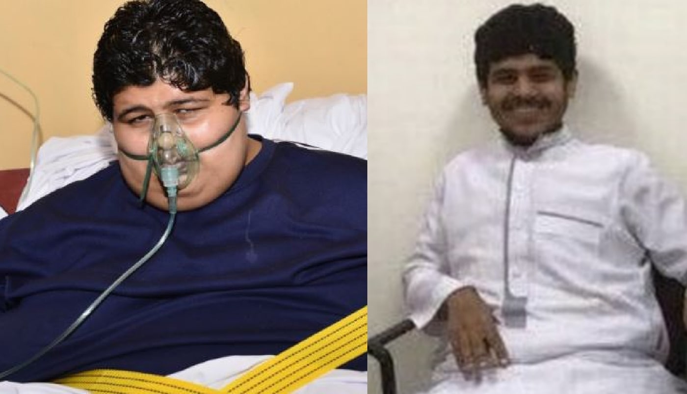 칼레드 모센 알 샤에리의 체중 감량 전후. (더선 갈무리) ⓒ 뉴스1