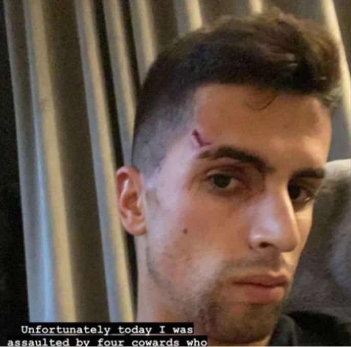 주앙 칸셀루가 집에서 강도에게 피습을 당했다. (주앙 칸셀루 SNS 화면 캡처)