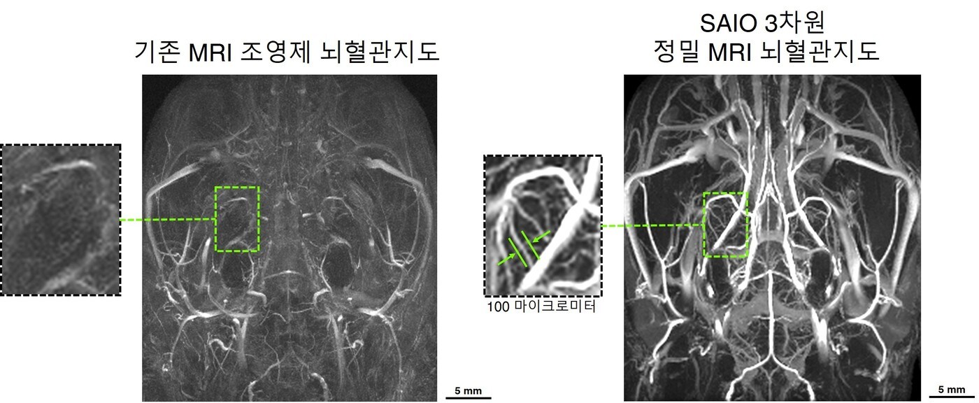 기존 조영제와 새로운 조영제를 활용해 촬영한 뇌 혈관 사진 (기초과학연구원 제공) 2021.03.08 /뉴스1