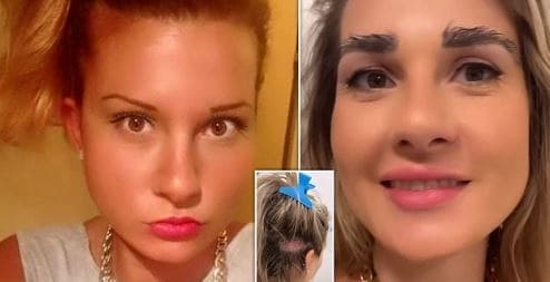 이자벨 쿠치의 눈썹 이식 시술 전과 후. 그는 뒤통수의 머리카락을 이식했다. (트위터 갈무리) ⓒ 뉴스1