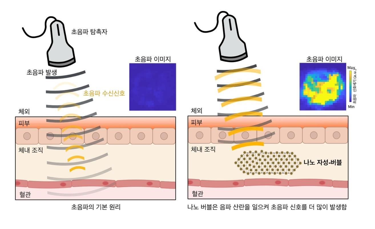 나노 자성-버블 초음파 영상 원리.&#40;IBS 제공&#41;/뉴스1