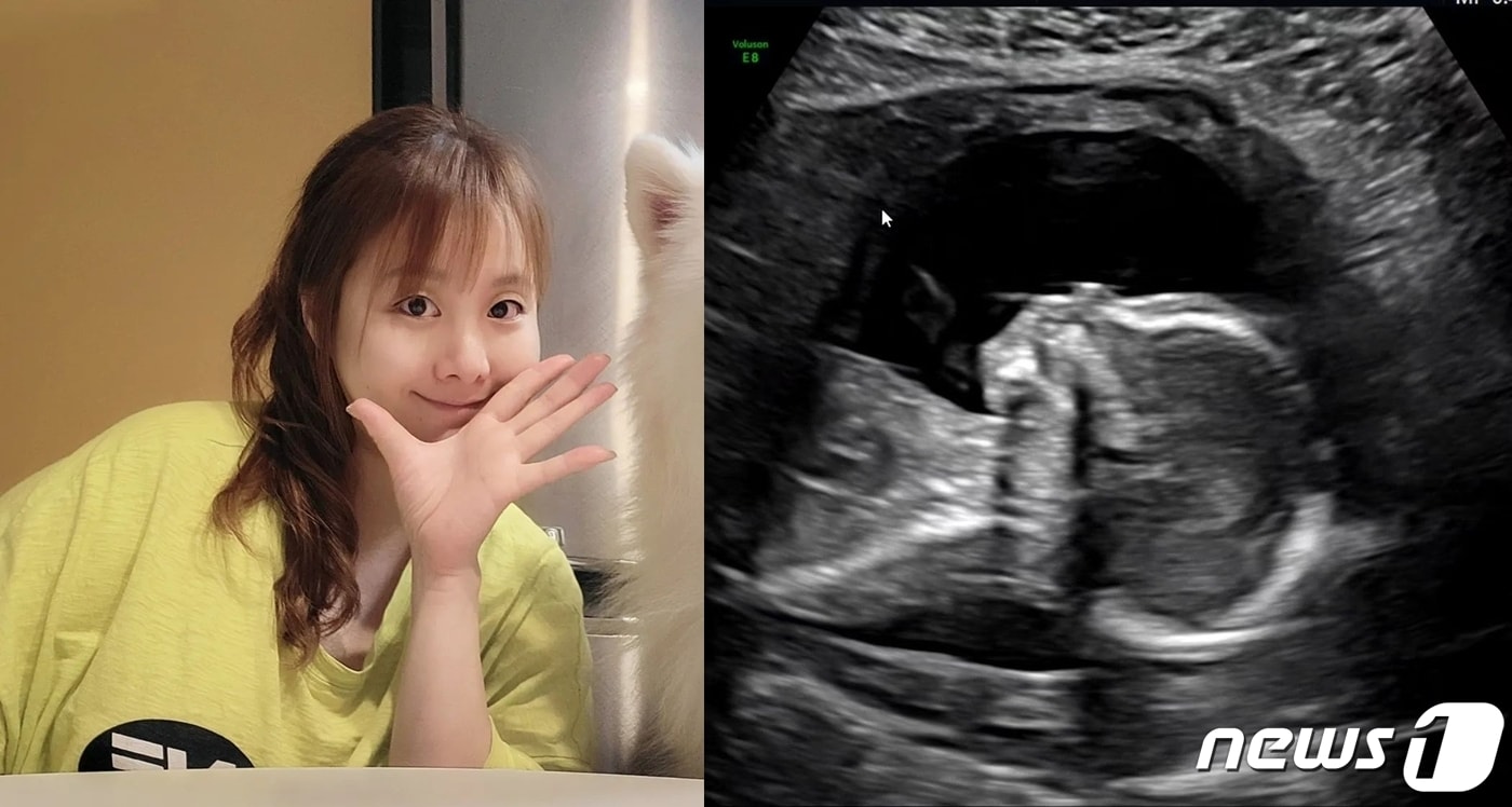 (노희지 인스타그램 갈무리) /뉴스1