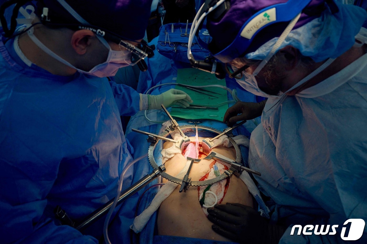 미국의 유전자변형 돼지 장기 이식 수술 장면. 2023.08.16. ⓒ AFP=뉴스1 ⓒ News1 권영미 기자