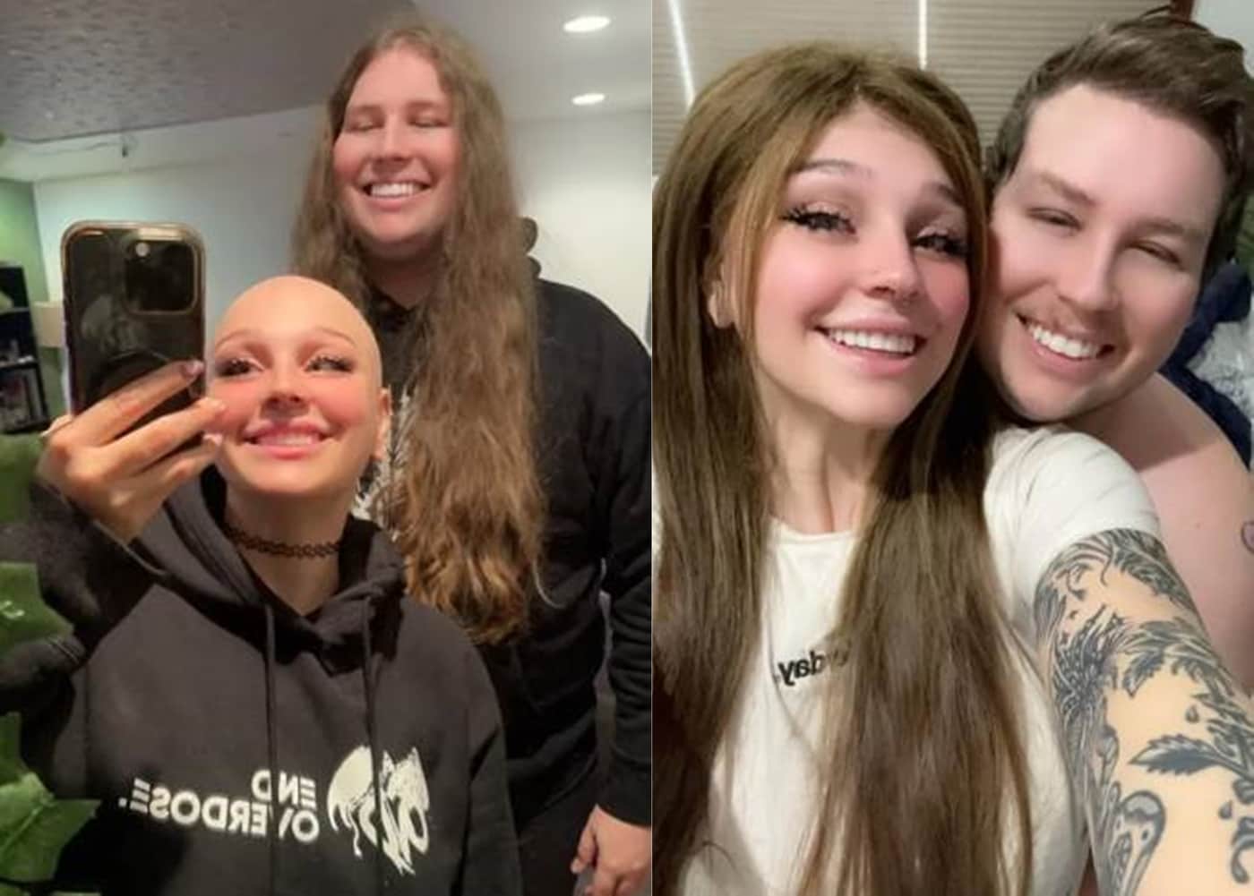 탈모로 힘들어하는 연인을 위해 4년간 기른 자신의 머리를 가발로 만들어 선물한 한 남성의 사연이 감동을 안기고 있다. 뉴욕포스트 갈무리