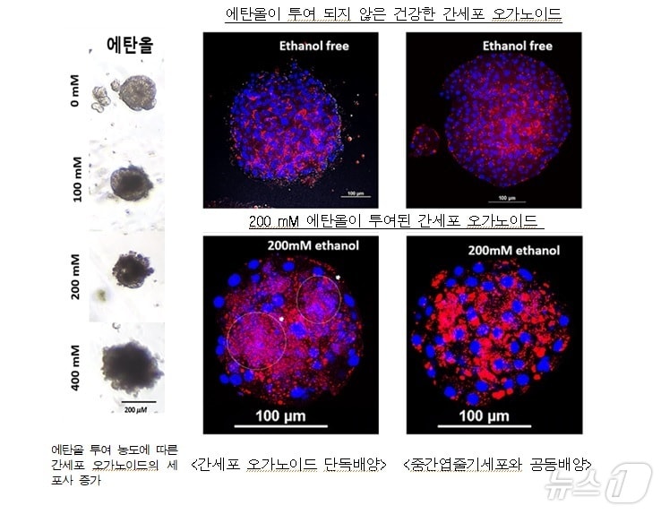 농촌진흥청은 돼지 간세포 오르가노이드를 이용해 알코올성 지방간 모형을 재현하는 데 성공했다고 14일 밝혔다. 돼지 간세포 오르가노이드&#40;미니 장기&#41; 관련 사진&#40;농진청 제공&#41; 2024.10.14/뉴스1