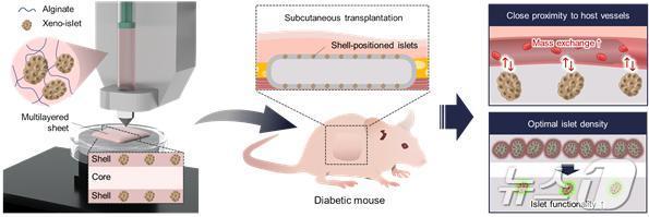 피하 췌도 이식의 개념도. &#40;UNIST 제공&#41;