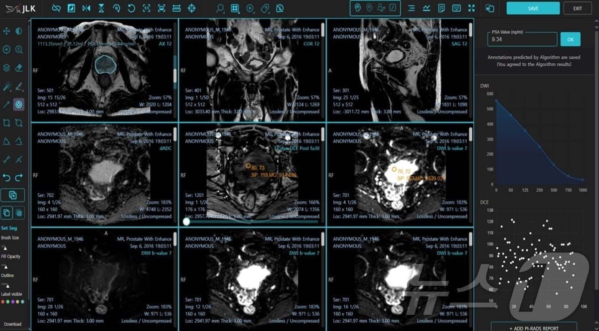 제이엘케이 AI 전립선암 진단 솔루션 &#39;MEDIHUB Prostate&#39;가 미국 식품의약국&#40;FDA&#41; 승인을 획득했다.&#40;제이엘케이 제공&#41; /뉴스1 ⓒ News1