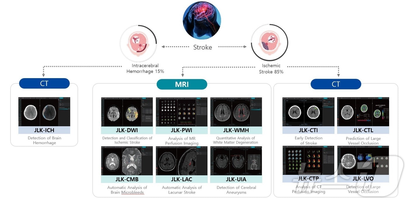  JLK Stroke Artificial Intelligence / 제이엘케이 뇌졸중전주기 풀 솔루션.&#40;제이엘케이 제공&#41;