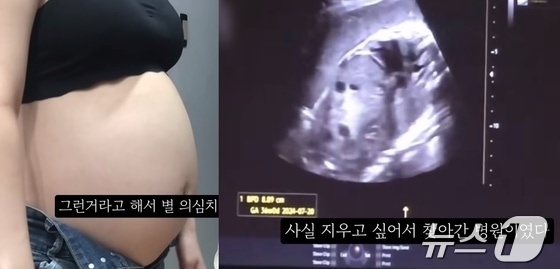 지난달 말 한 유튜버가 임신 36주차 태아의 초음파 사진을 공개하면서 '900만원을 들여 낙태했다'고 밝혀 '영아 살해'논란에 휩싸였다. (유튜브 갈무리) ⓒ 뉴스1 