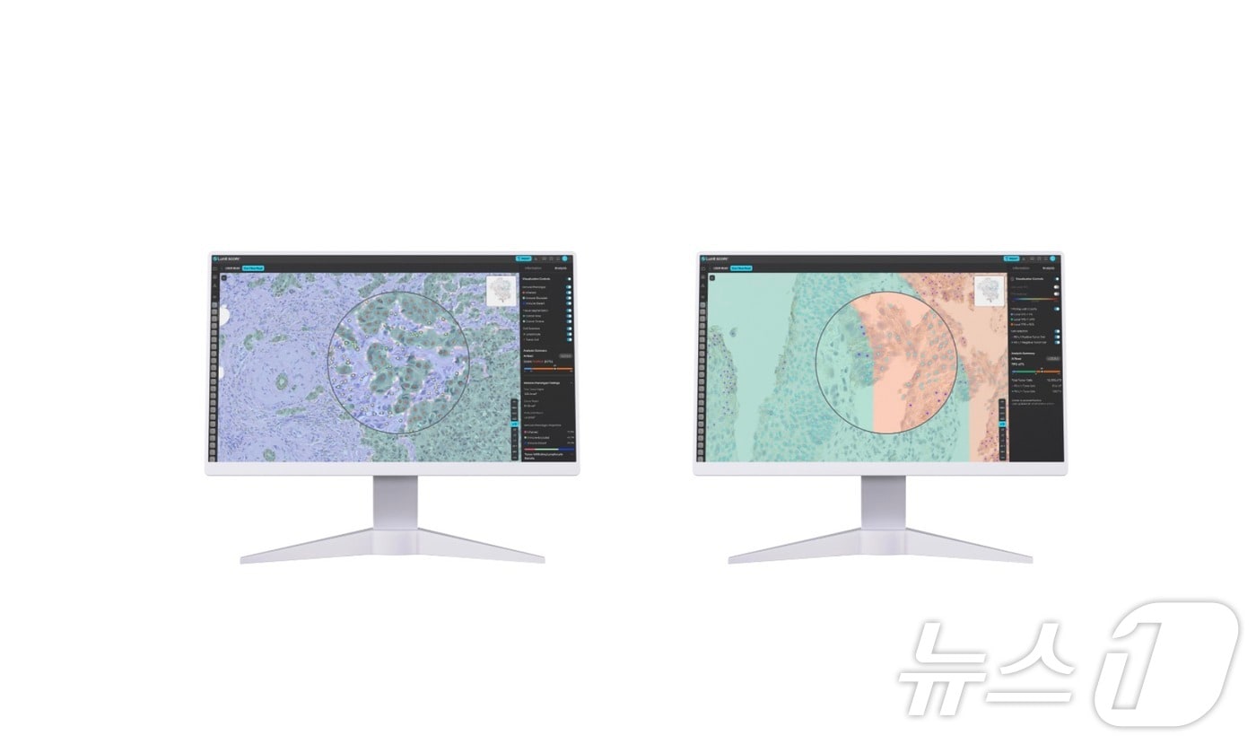   루닛 스코프 IO&#40;왼쪽&#41; 및 루닛 스코프 PD-L1.&#40;이미지 제공=루닛&#41;