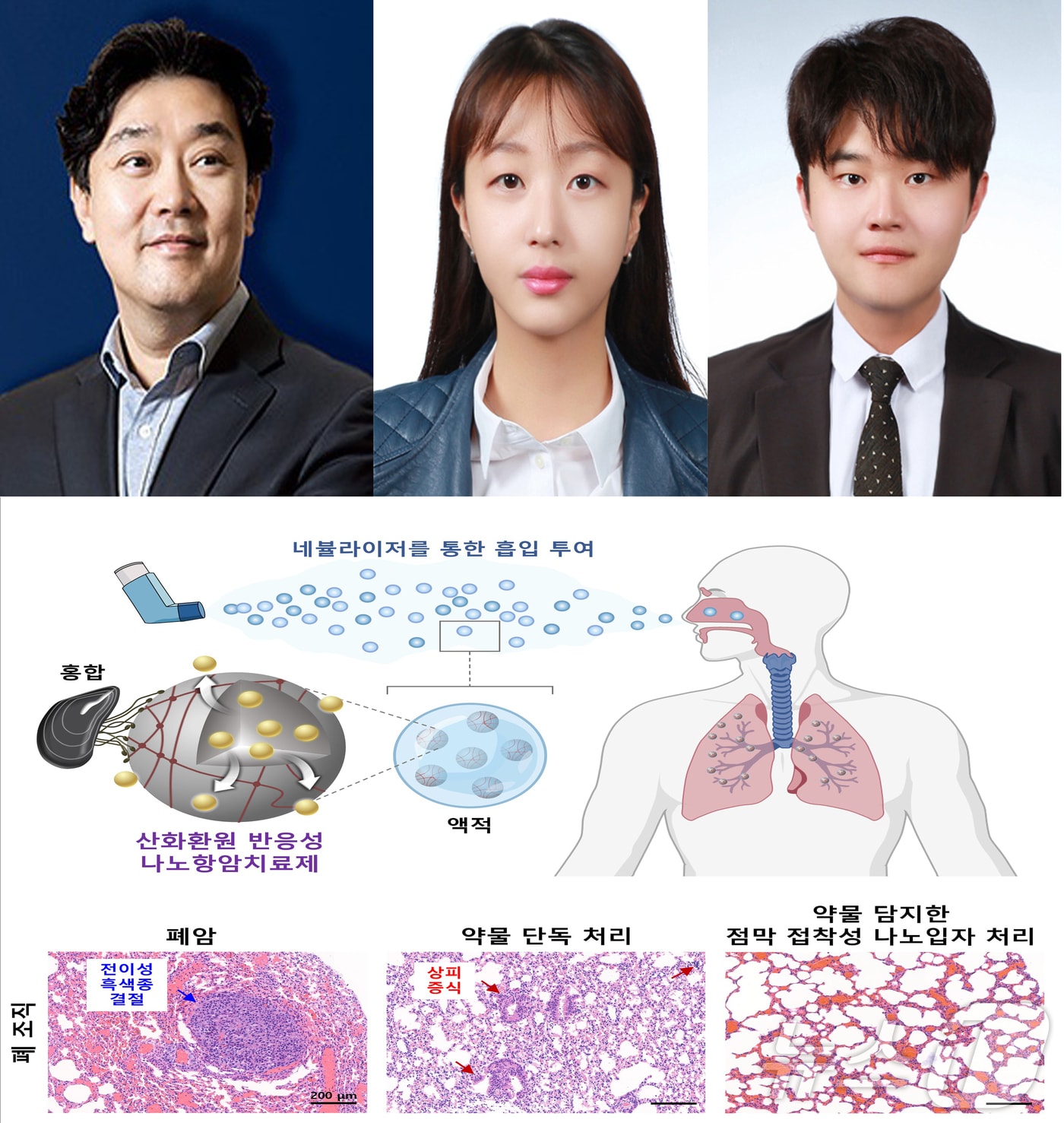 포스텍(포항공대)과 경북대 공동연구팀이 홍합 접착 단백질을 활용한 폐암 치료용 흡입형 생체 나노입자를 개발했다고 2일 밝혔다. 사진 왼쪽부터 차형준 교수, 정연수 박사, 조윤기 교수, 연구성과 이미지. (포스텍제공) 20251.2/뉴스1