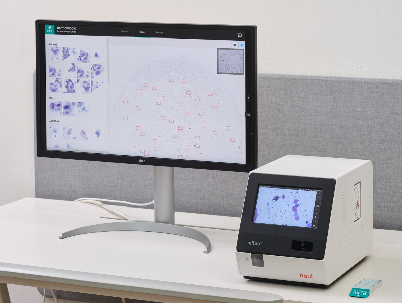  노을 AI 기반 자궁경부암 진단 솔루션 'miLab CER'. (노을 제공)