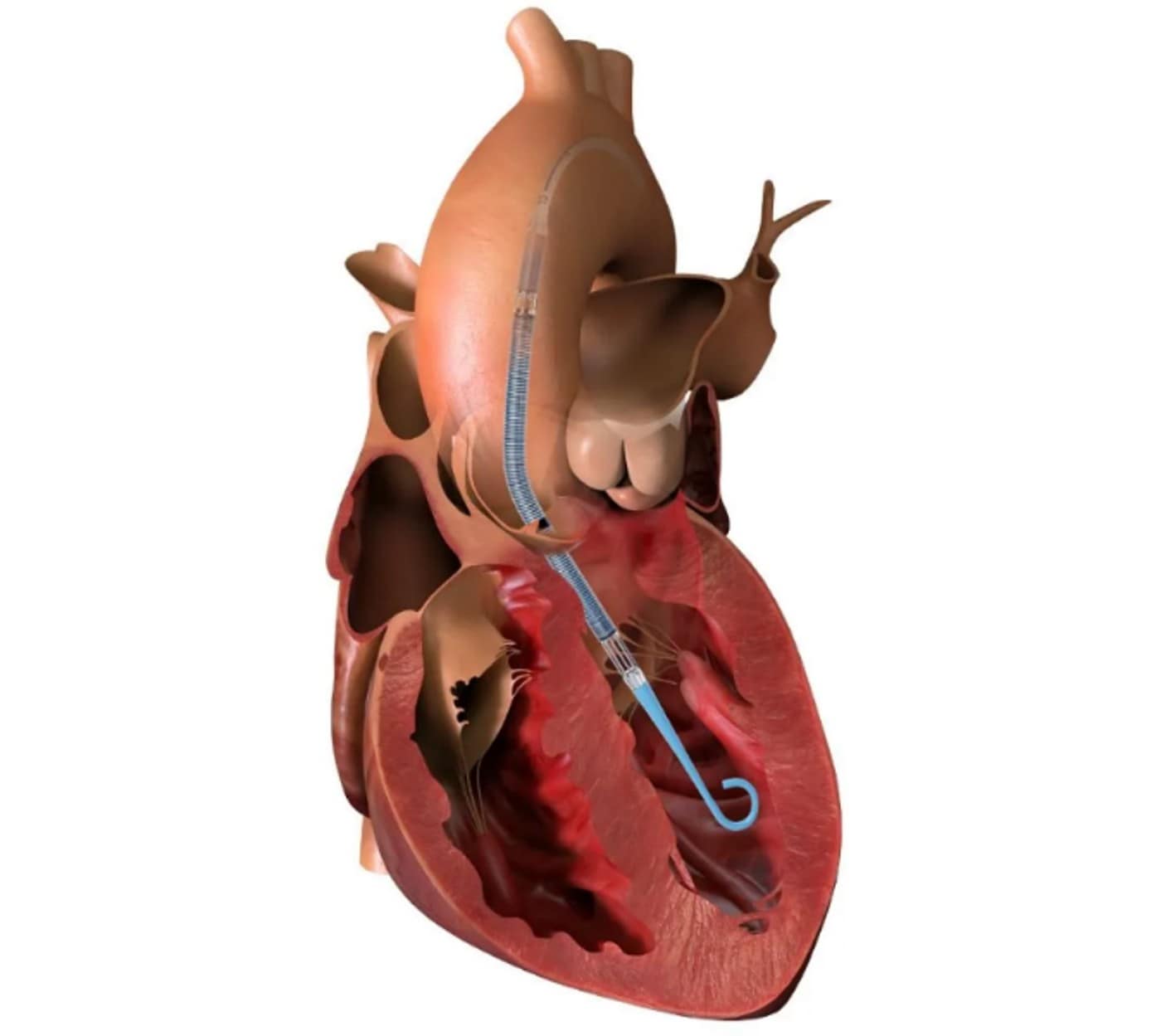 &#40;존슨앤드존슨 메드테크 제공&#41;