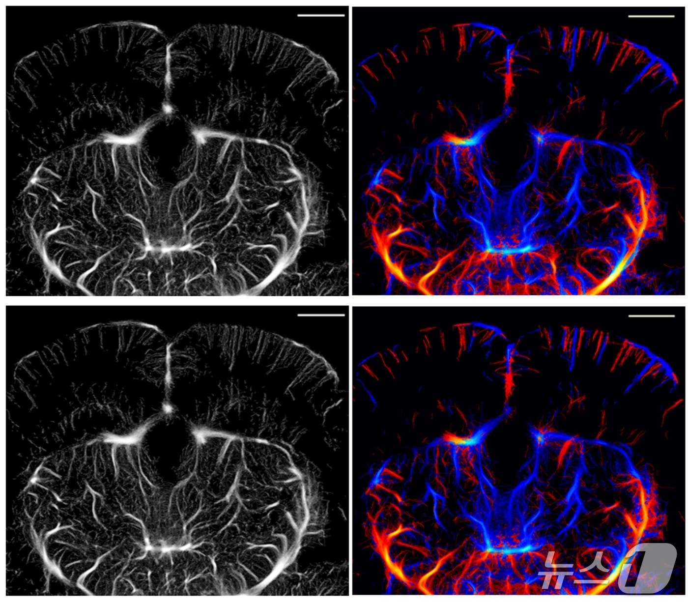 ULM으로 획득한 쥐 뇌 모세혈관 영상&#40;위&#41;과 ULM-Lite 기법으로 획득한 모세혈관 영상.&#40;DGIST 제공, 재판매 및 DB 금지&#41;