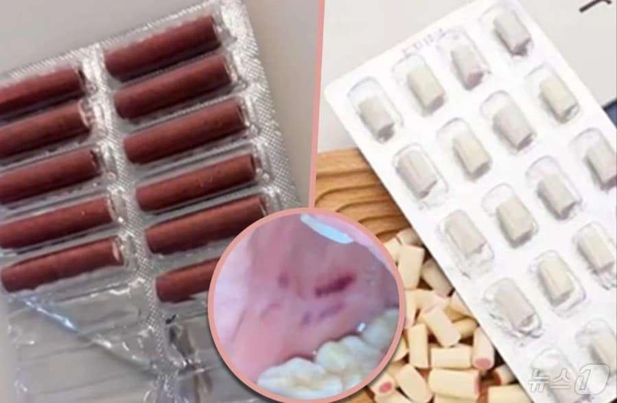 관련 시각물. 동그라미 부분이 입안의 상처. - SCMP 갈무리