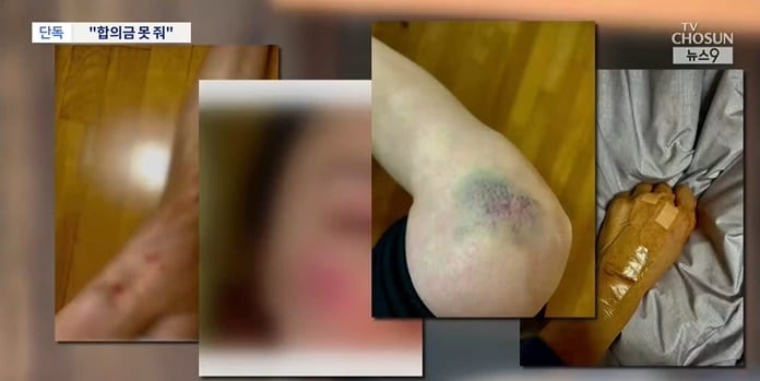 (TV조선 갈무리)