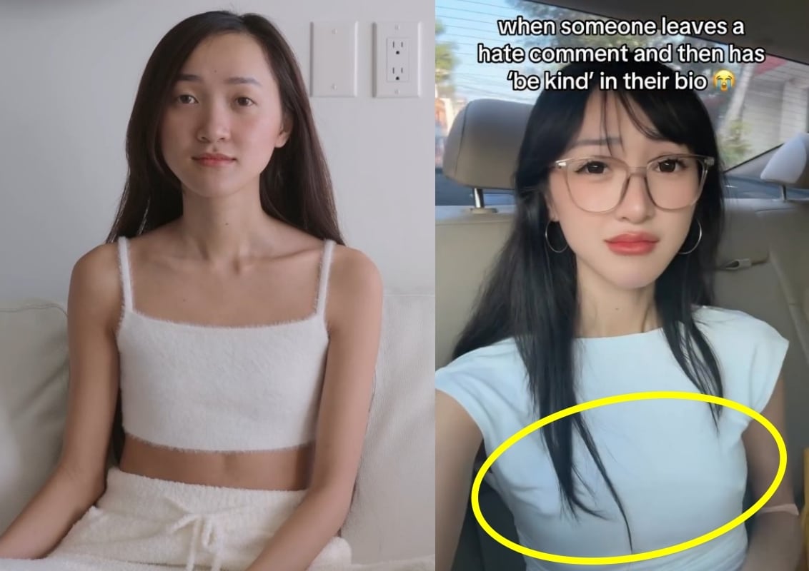 바디 포지티브를 주장하던 클라라 다오(왼쪽), 한 달 전 누리꾼들이 그녀가 가슴 수술 받았다고 의심하는 모습(오른쪽).(클라라 다오 SNS 갈무리)