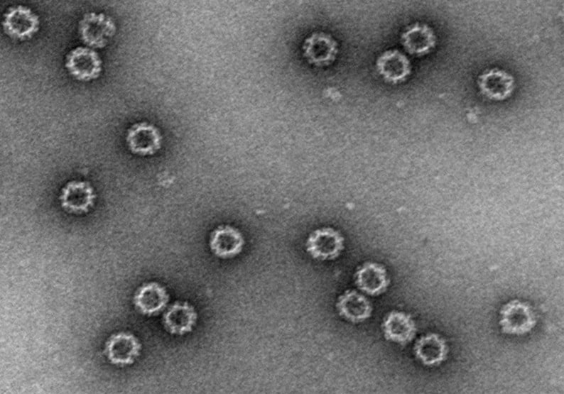  노로바이러스 바이러스 유사입자(VLP) 전자현미경 사진. (인테라 제공)
