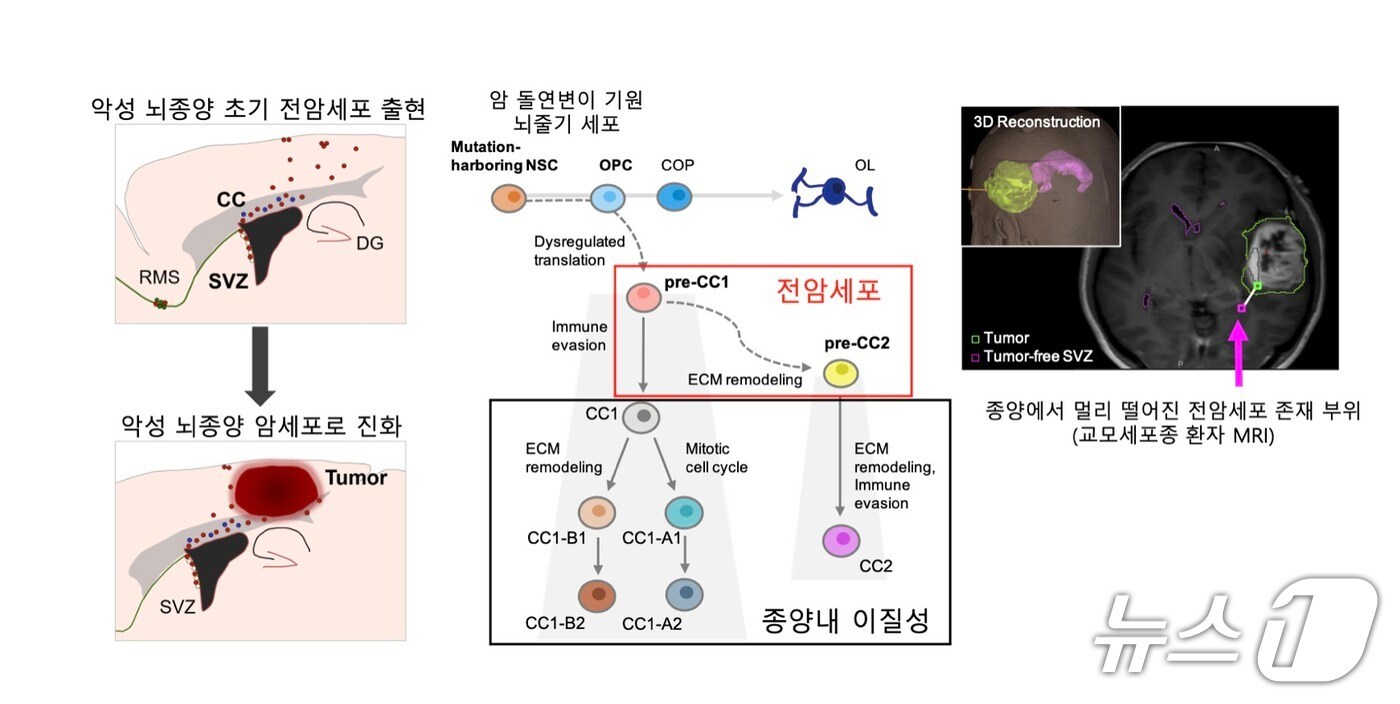 교모세포종 발별과 치료 저항성의 원인이 되는 전암세포 규명 연구 개념도. (KAIST제공. 재판매 및 DB금지) /뉴스1