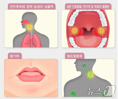 성홍열 증상 이미지.(광주시 제공. 재판매 및 DB 금지) ⓒ News1 박준배 기자