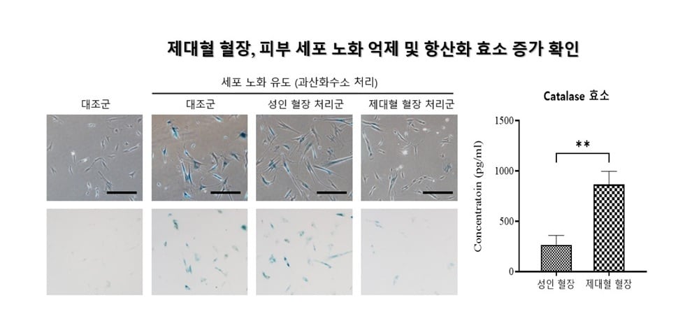  제대혈 혈장, 피부 세포 노화 억제 및 항산화 효소 증가 확인. (메디포스트 제공)