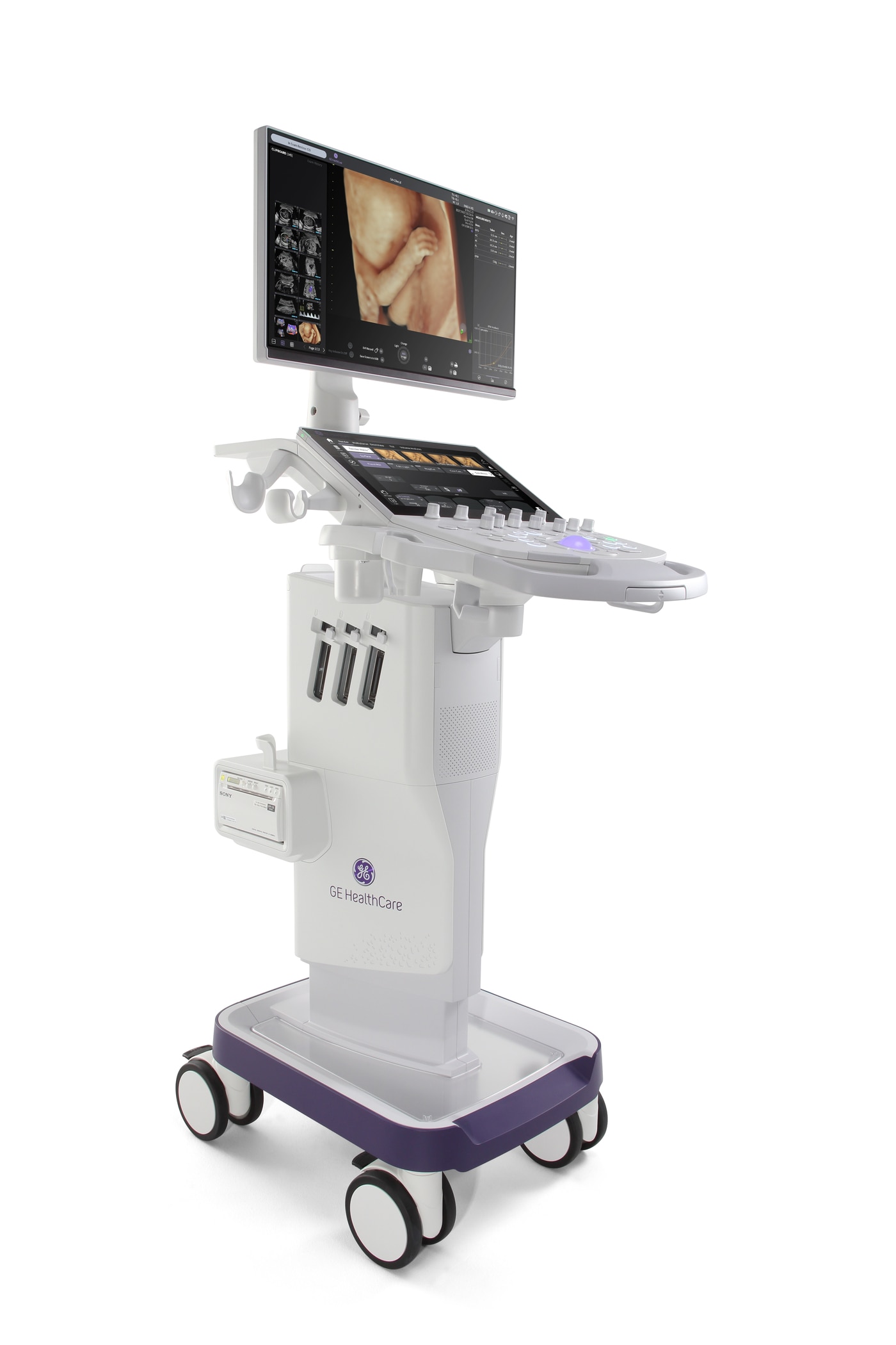 GE헬스케어 초음파 신제품 '볼루손 퍼포먼스 시리즈'. (GE헬스케어 제공)