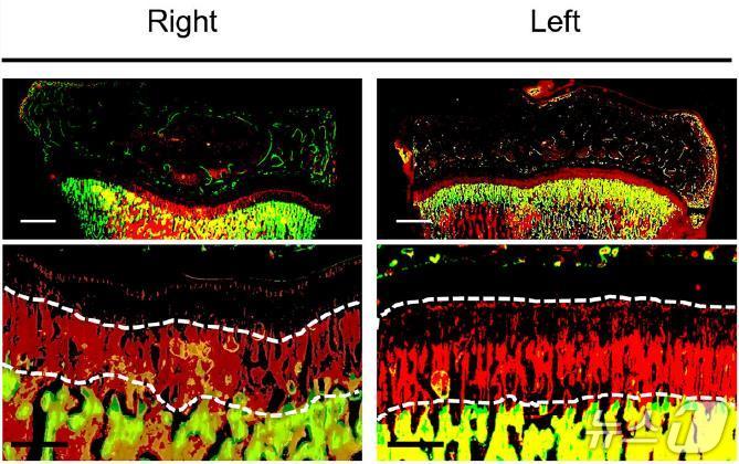 왼쪽 정강이뼈 성장판으로부터 10㎜떨어진 곳에 구멍을 만든 뼈가 정상적인 뼈보다 성장 자극 효과가 뛰어난 것으로 보여주는 사진.(해운대백병원 제공. 재판매 및 DB 금지)