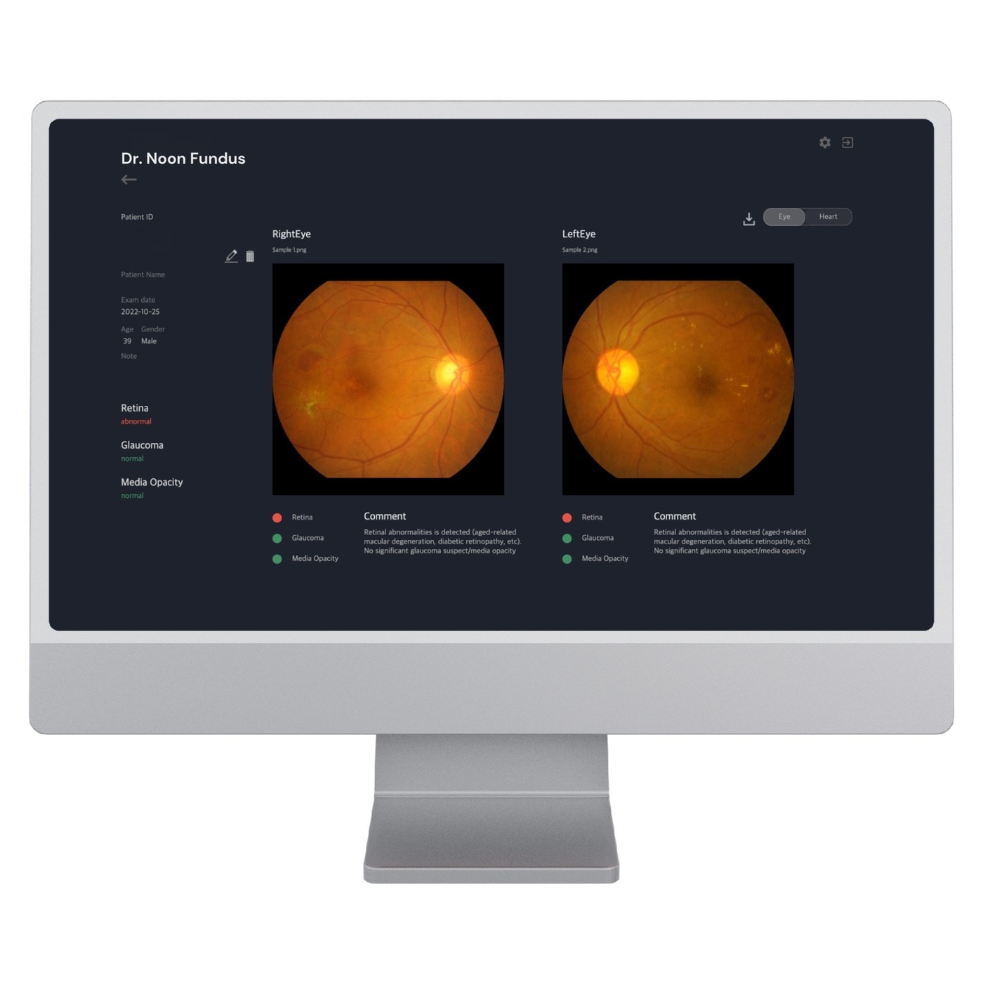  메디웨일의 안질환 진단보조 AI 솔루션 '닥터눈 펀더스'. (메디웨일 제공)