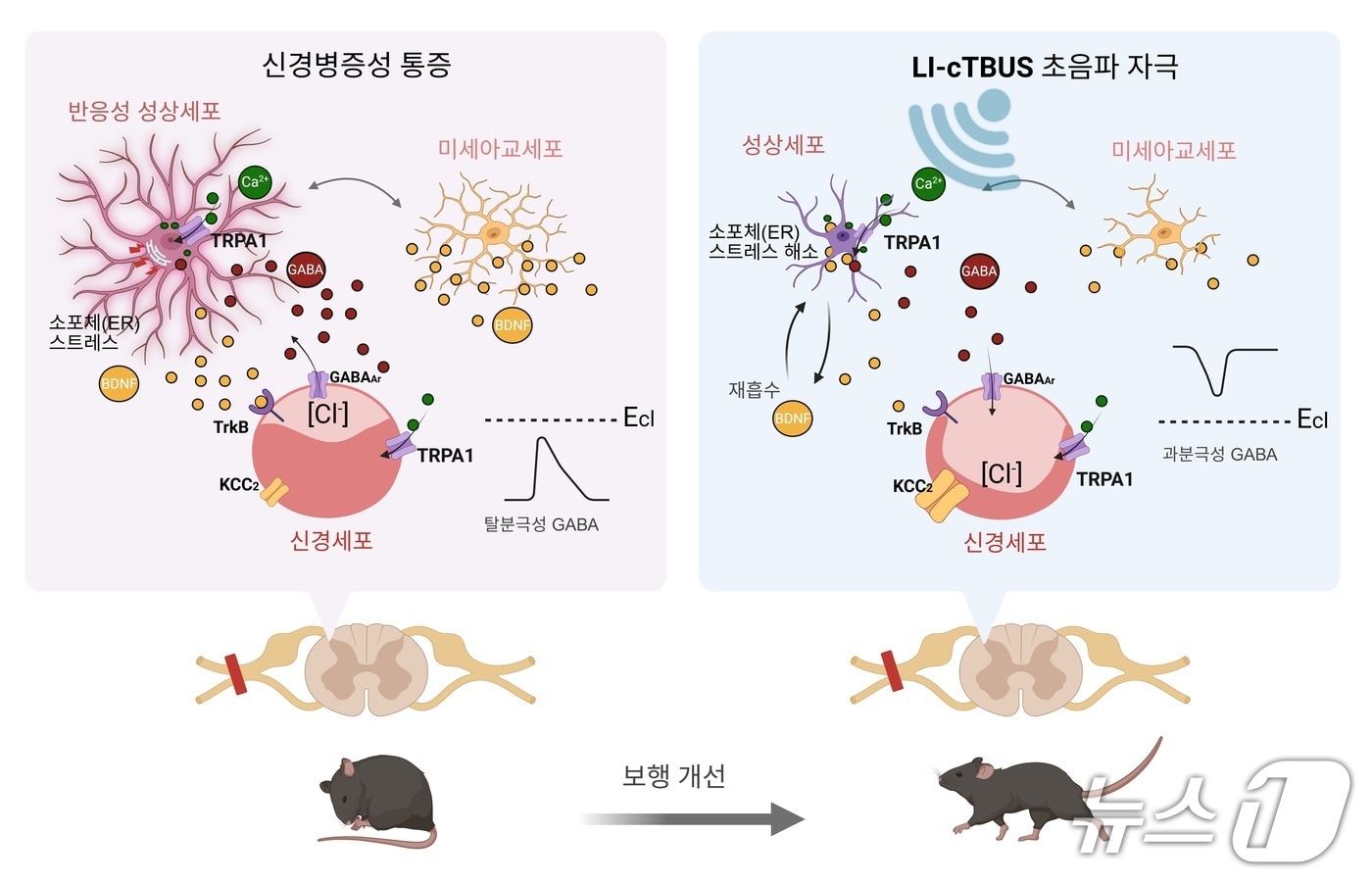 비침습적 저강도 초음파 자극이 통증을 완화하는 작동 원리(IBS 제공) /뉴스1