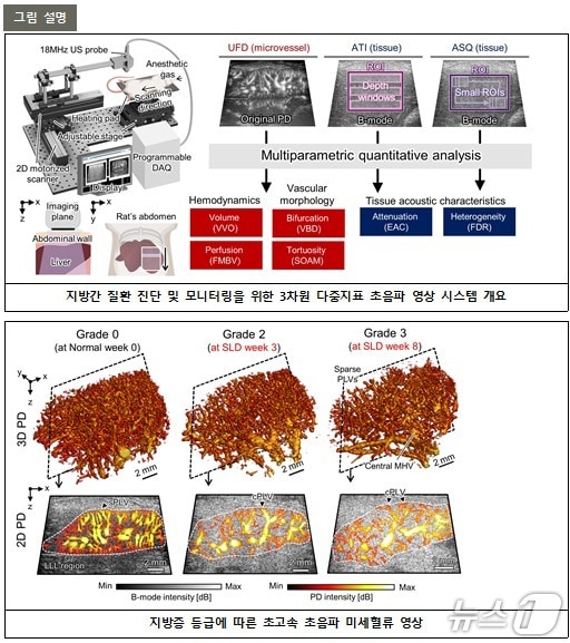 포스텍 김철홍·안용주 교수팀이 초음파를 이용해 촬영한 간 속 혈관 3차원 영상.(포스텍 제공, 재판매 및 DB금지) 2026.113/뉴스1 
