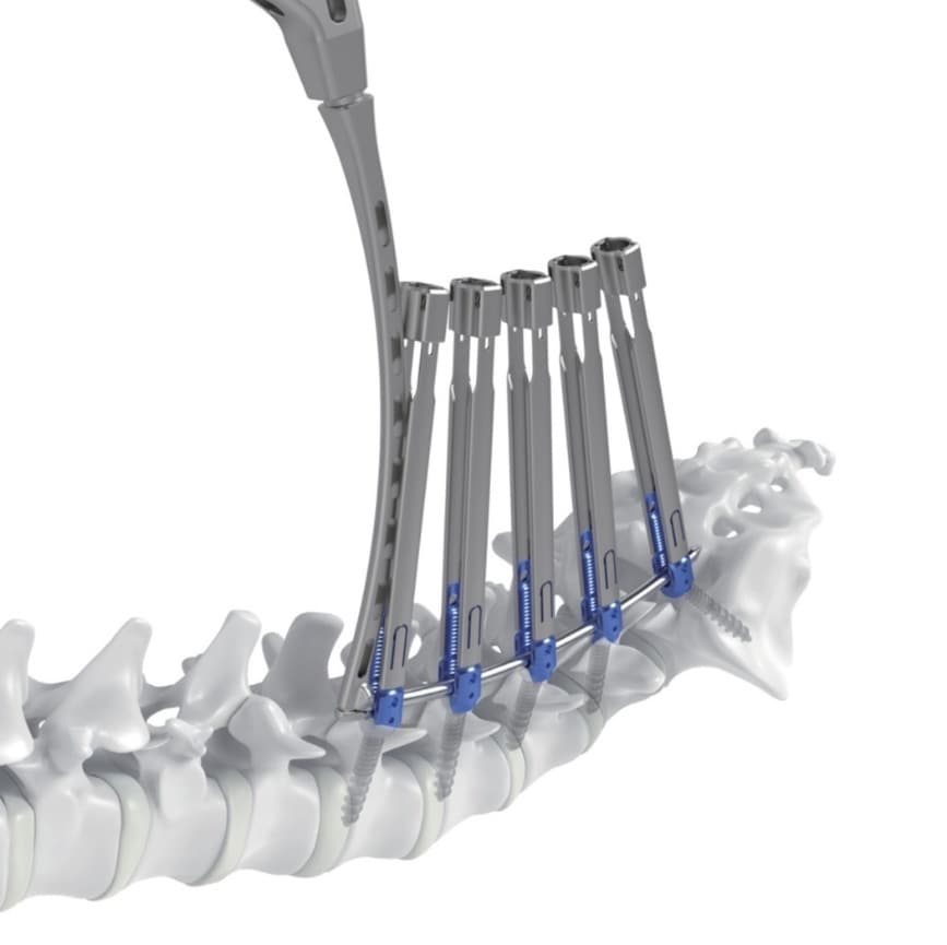 메드트로닉코리아가 ‘강휘’를 출시하며 메드트로닉 척추 솔루션에 대한 접근성을 확대한다. (메드트로닉코리아 제공)