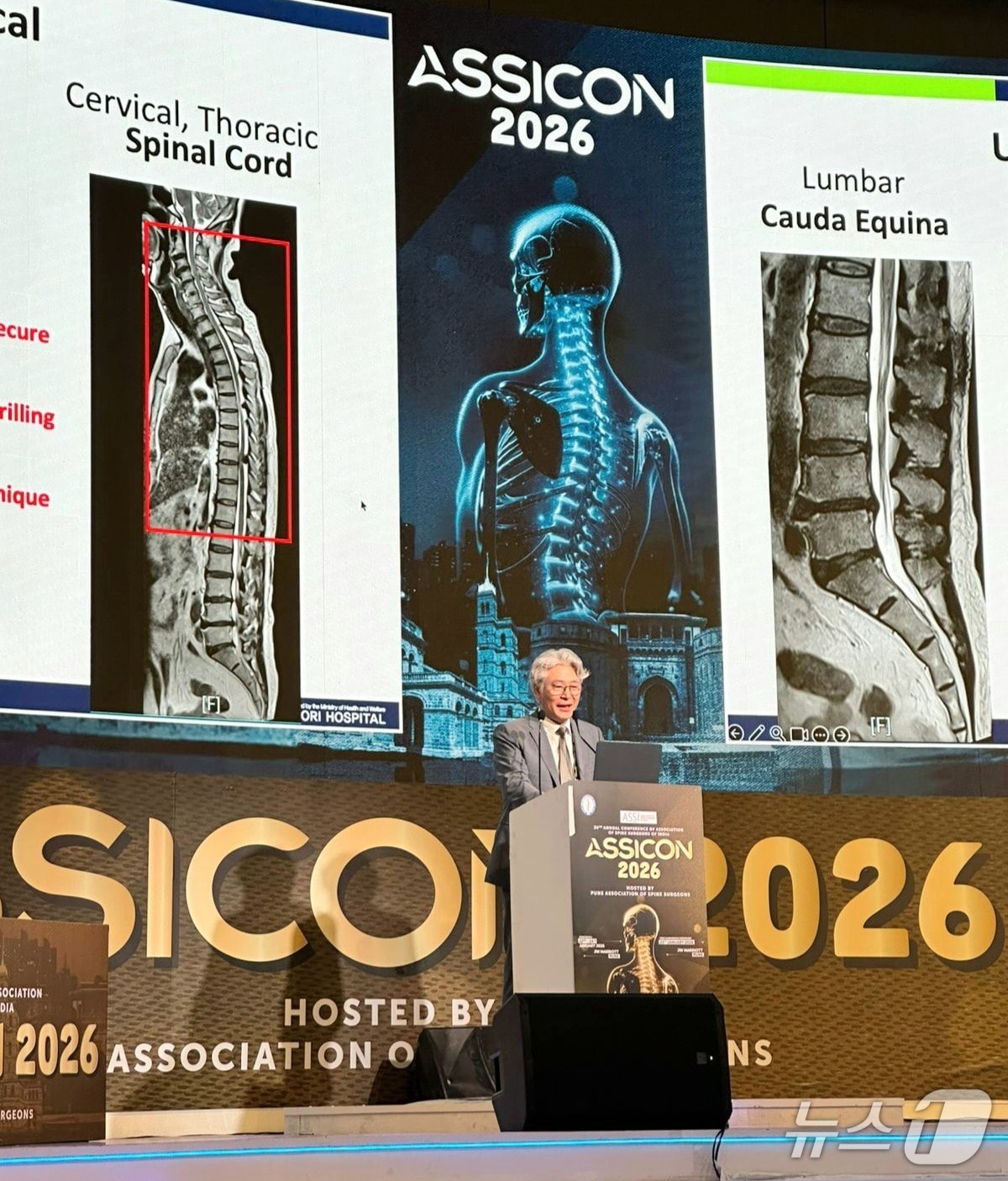 박철웅 대전우리병원 원장이 인도 푸네에서 열린 제39회 인도척추외과학회 연례 학술대회에서 강연 중인 모습. (대전우리병원 제공, 재판매 및 DB금지) / 뉴스1