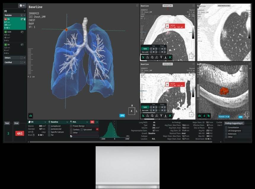 '1세대 의료 AI' 코어라인소프트, 유럽 성과로 '안정적 성장' 입증[문대현의 메디뷰]