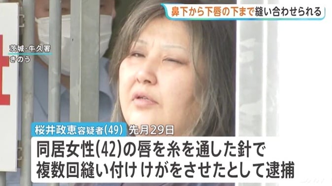 TBS 갈무리