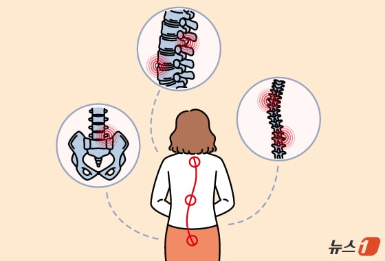 'FDA 다음은 수술실'...美서 겨루는 K-척추 임플란트[문대현의 메디뷰] - 뉴스 썸네일 이미지