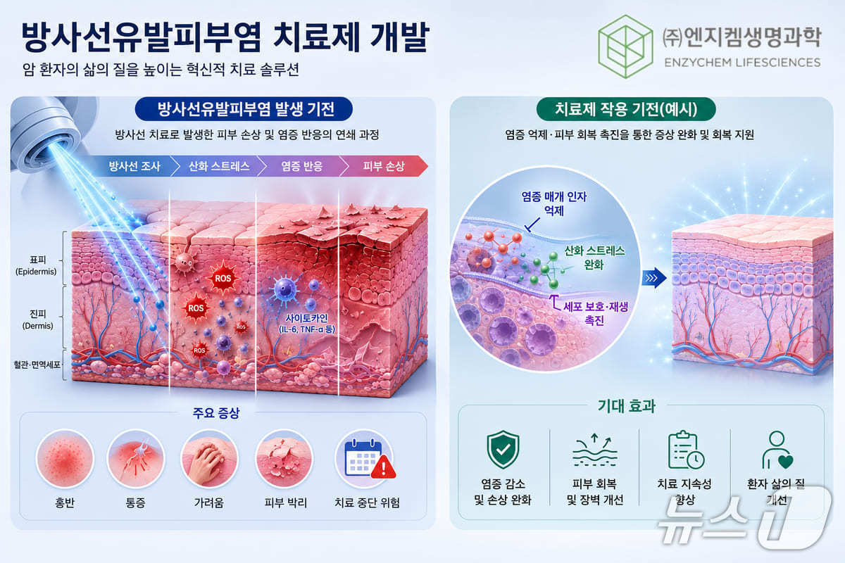 엔지켐생명과학, 방사선 피부염 치료제 개발 나선다 - 뉴스 썸네일 이미지